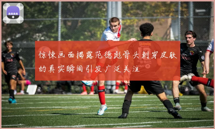 惊悚画面揭露范德彪骨头刺穿皮肤的真实瞬间引发广泛关注